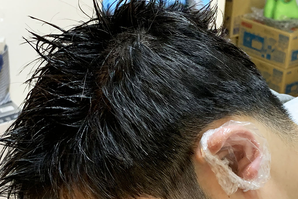 髪の生え際は結構難しい